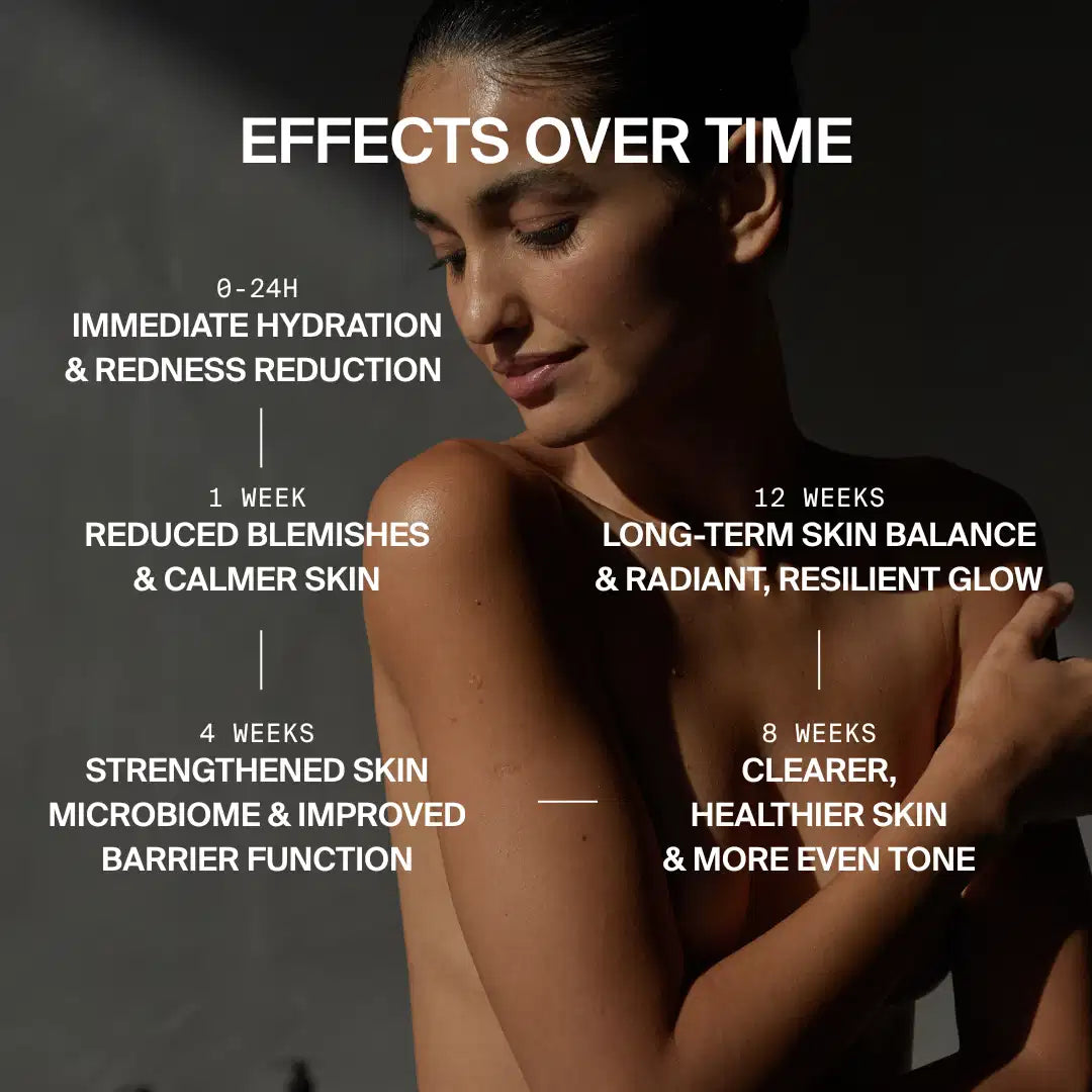 Eine Frau mit strahlender Haut posiert vor einem dunklen Hintergrund. Der eingeblendete Text hebt die Vorteile von DALUMA PREBIOTIC PURIFYING GESICHTSSERUM hervor: Feuchtigkeitszufuhr, Verringerung von Rötungen und Hautunreinheiten, Stärkung der Hautbarriere und strahlendes Aussehen.